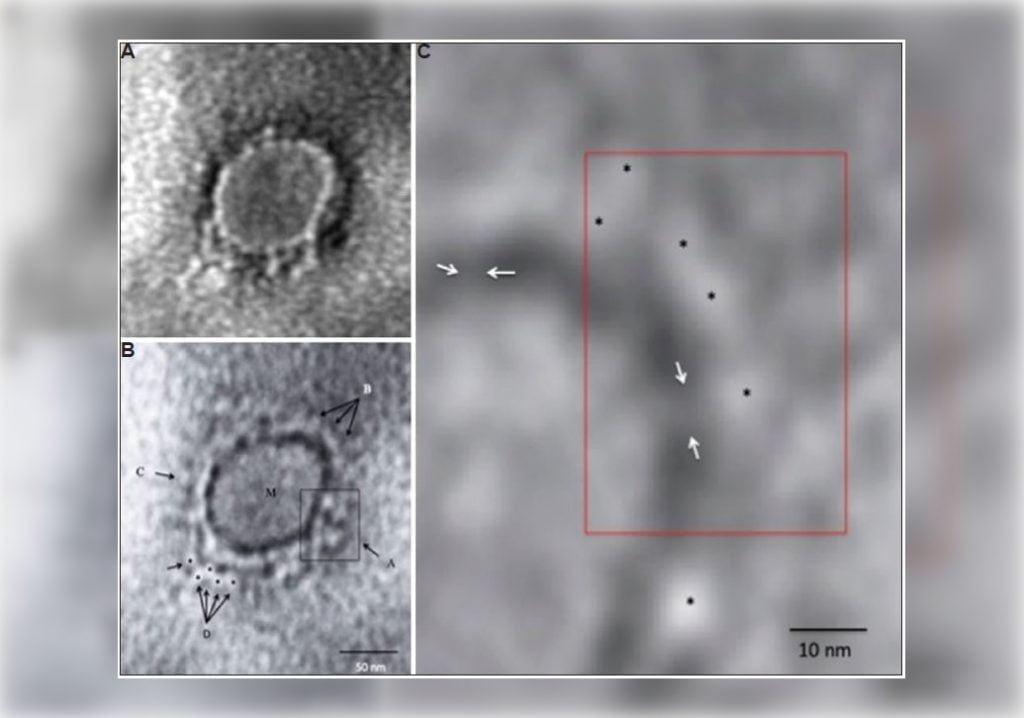 covid-19 microscopic image