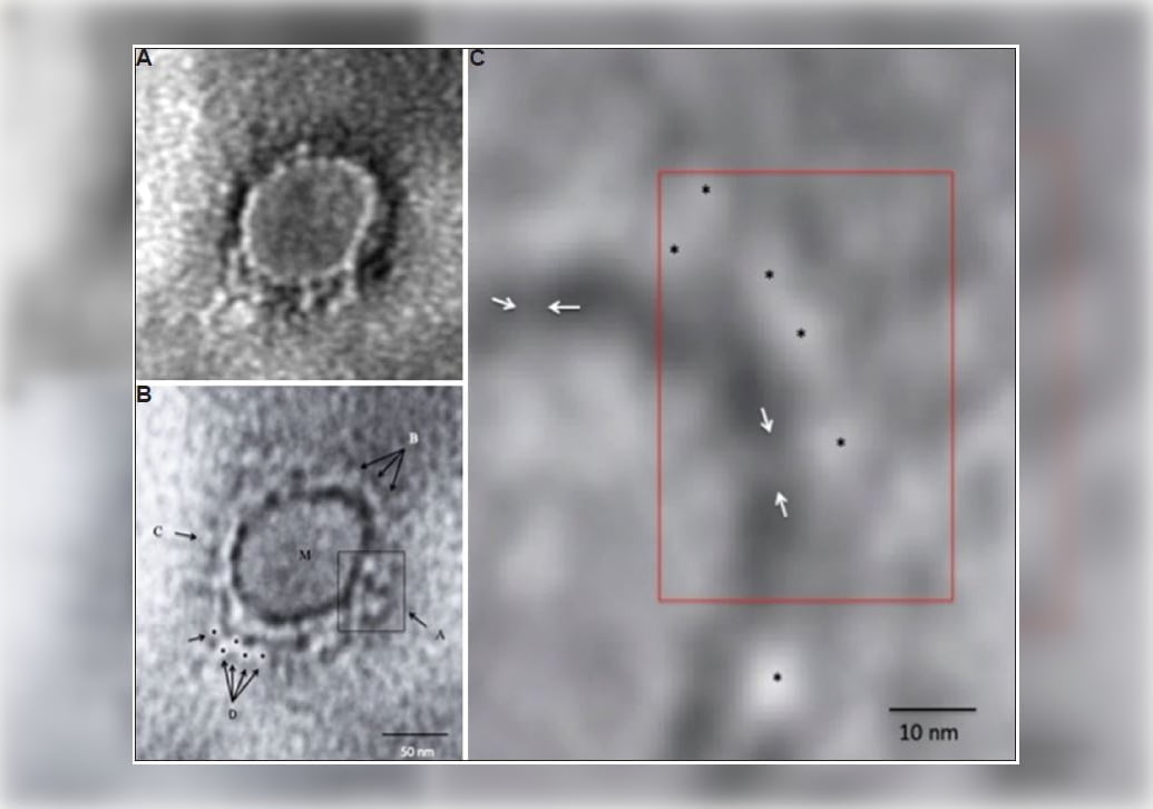 covid-19 microscopic image
