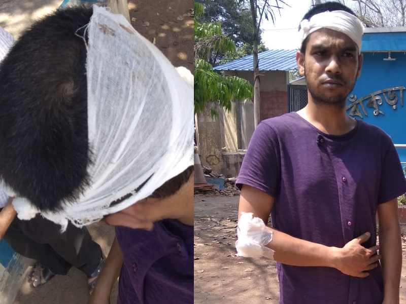 আলো না নেভানোর অপরাধে মাথা ফাটল বাংলা পক্ষের সদস্যের, অভিযুক্ত বিজেপি। আলো না নেভানোর অপরাধে মাথা ফাটল বাংলা পক্ষের সদস্যের, অভিযুক্ত বিজেপি।