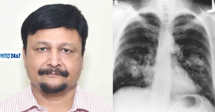 ৩-৫ সেকেন্ডে শনাক্ত করা হবে করোনা ভাইরাস, চাঞ্চল্য ফেলল আইআইটি অধ্যাপকের গবেষণা ৩-৫ সেকেন্ডে শনাক্ত করা হবে করোনা ভাইরাস, চাঞ্চল্য ফেলল আইআইটি অধ্যাপকের গবেষণা