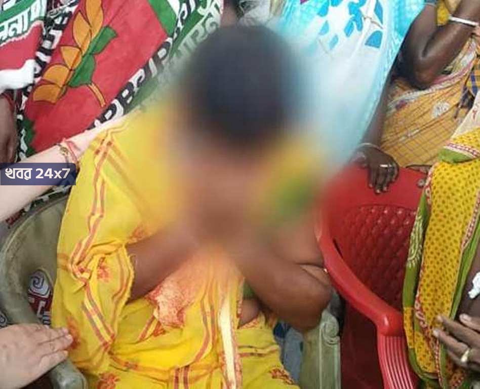 স্বামী বিজেপি সমর্থক হওয়ার 'অভিযোগে' বসিরহাটে স্ত্রীর ওপর চরম শারীরিক নির্যাতন তৃণমূল নেতৃত্বের! agnimitra in haroa