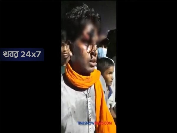 নৃশংস! দোষ হেলমেট পরেনি! চাবি কপালে ঢুকিয়ে শাস্তি দিল পুলিশ! দেখুন ভিডিও!