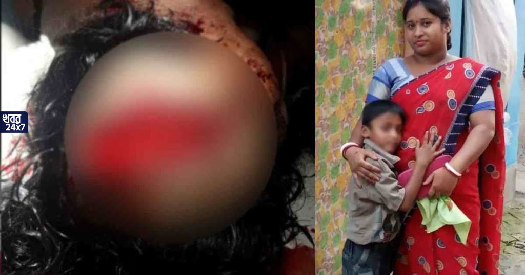গেরুয়া শিবিরের সদস্য হওয়ার অপরাধে গুলিবিদ্ধ মহিলা, অভিযোগের তির তৃণমূলের দিকে গেরুয়া শিবিরের সদস্য হওয়ার অপরাধে গুলিবিদ্ধ মহিলা, অভিযোগের তির তৃণমূলের দিকে