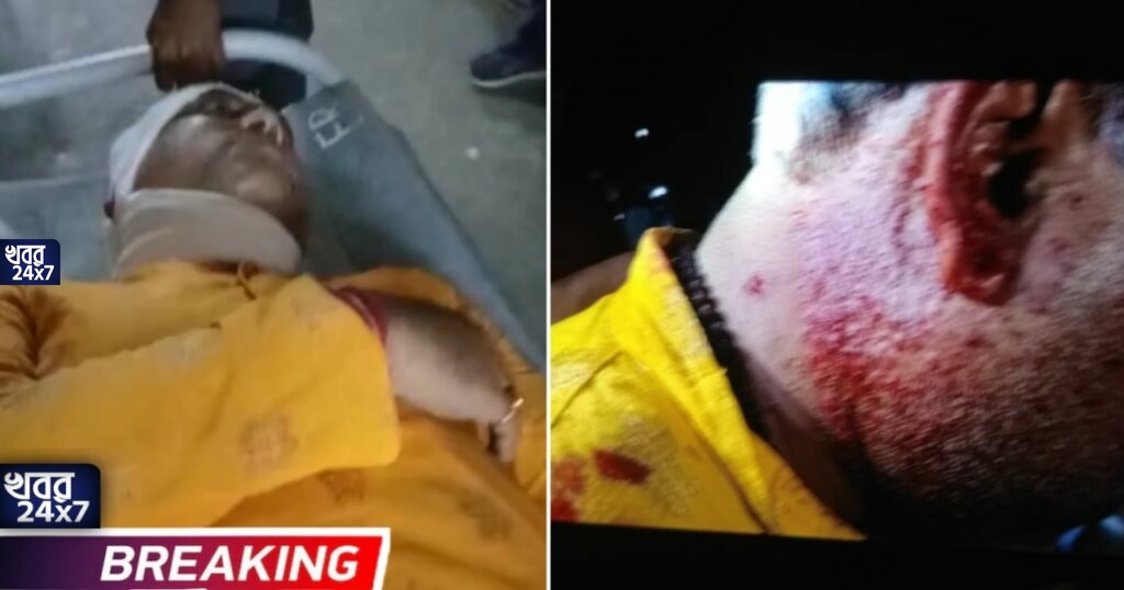 BREAKING: গলায় গুলি লেগে আশঙ্কাজনক অবস্থায় হাসপাতালে ভর্তি বিজেপি প্রার্থী! কাঠগড়ায় তৃণমূল