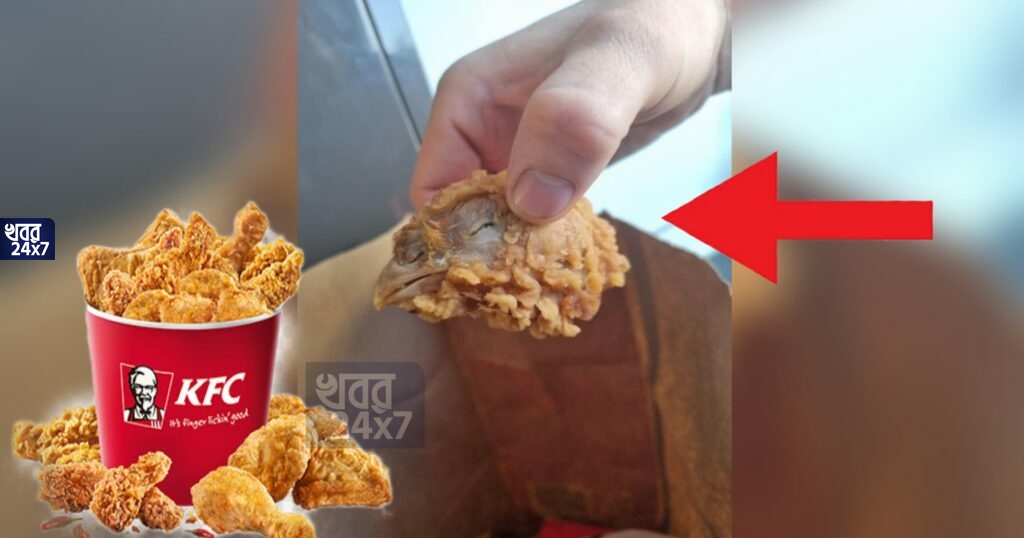 KFC-এর হট উইংসে কামড় দিতেই মিলল ঠোঁট-পালকসহ আস্ত মুরগির মাথা, নেটপাড়ায় সমালোচনার ঝড় KFC-এর হট উইংসে কামড় দিতেই মিলল ঠোঁট-পালকসহ আস্ত মুরগির মাথা, নেটপাড়ায় সমালোচনার ঝড়