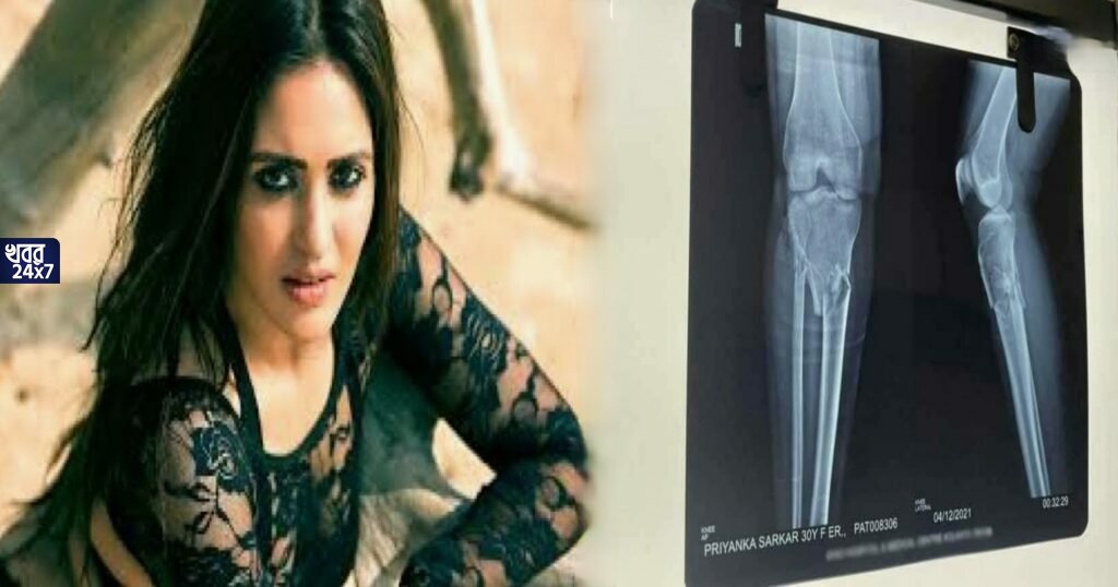 শুটিং করতে গিয়ে এ কী বিপত্তি! মত্ত বাইকারের ধাক্কায় পায়ের হাড় ভেঙে দু টুকরো হল প্রিয়াঙ্কা সরকারের! শুটিং করতে গিয়ে এ কী বিপত্তি! মত্ত বাইকারের ধাক্কায় পায়ের হাড় ভেঙে দু টুকরো হল প্রিয়াঙ্কা সরকারের!