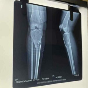 শুটিং করতে গিয়ে এ কী বিপত্তি! মত্ত বাইকারের ধাক্কায় পায়ের হাড় ভেঙে দু টুকরো হল প্রিয়াঙ্কা সরকারের! শুটিং করতে গিয়ে এ কী বিপত্তি! মত্ত বাইকারের ধাক্কায় পায়ের হাড় ভেঙে দু টুকরো হল প্রিয়াঙ্কা সরকারের!