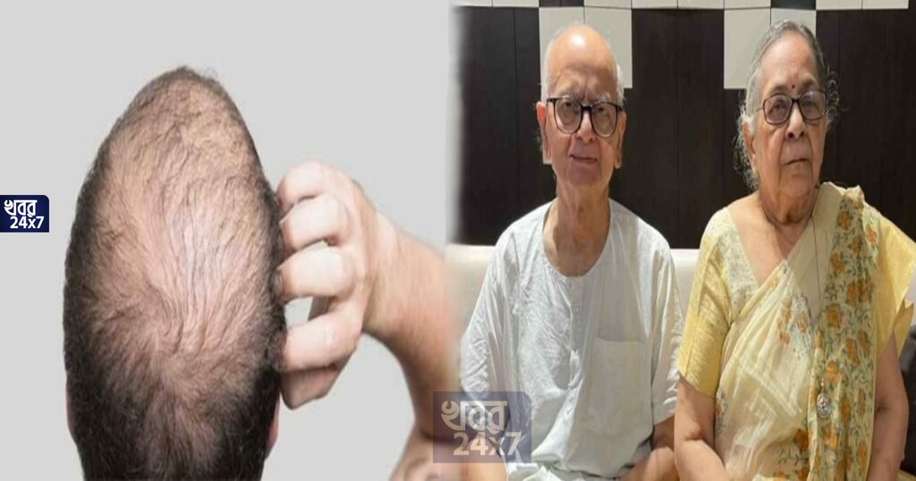 ভাবা যায়? অতিরিক্ত চুল পড়ার সমস্যার সমাধান খুঁজতে গিয়ে টাকে চুল গজানোর তেল আবিষ্কার বছর ৮৫-এর দম্পতির
