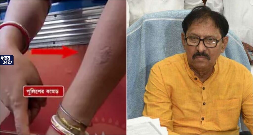 ‘প্ররোচনা দিলে অনেক কিছুই হতে পারে’, চাকরিপ্রার্থীকে পুলিশের কামড়ে দেওয়ার ঘটনাকে সমর্থন করে মন্তব্য বিধানসভার স্পিকারের ‘প্ররোচনা দিলে অনেক কিছুই হতে পারে’, চাকরিপ্রার্থীকে পুলিশের কামড়ে দেওয়ার ঘটনাকে সমর্থন করে মন্তব্য বিধানসভার স্পিকারের
