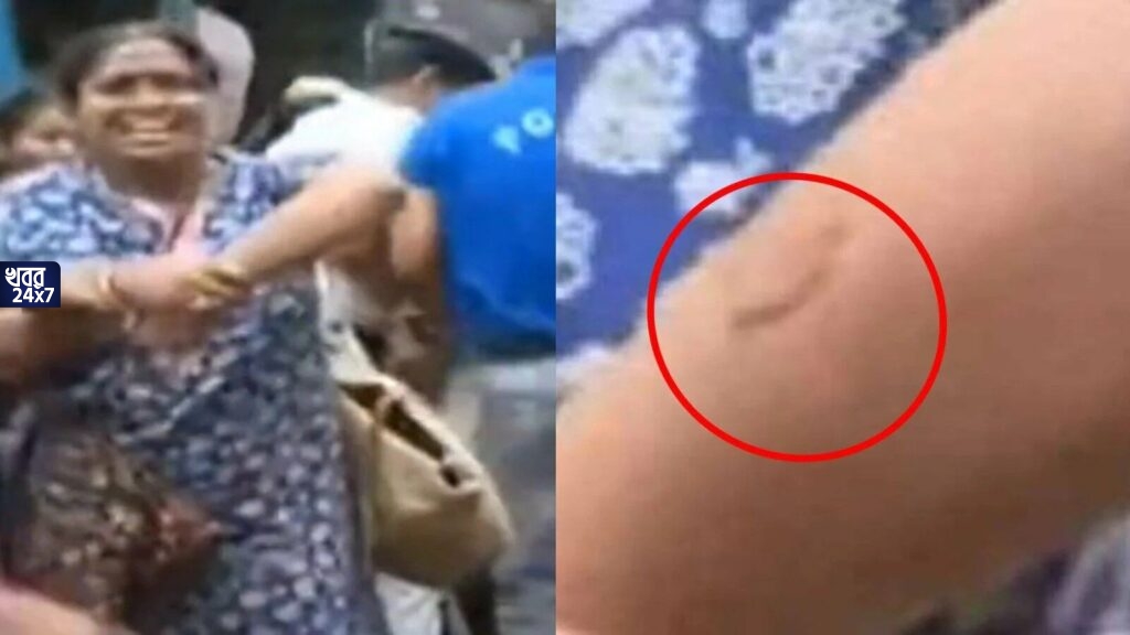 অদ্ভুত বিচার! পুলিশকর্মী কামড়ে দিয়েছিলেন, অথচ সেই চাকরিপ্রার্থীর বিরুদ্ধেই মামলা দায়ের হল জামিন অযোগ্য ধারায় অদ্ভুত বিচার! পুলিশকর্মী কামড়ে দিয়েছিলেন, অথচ সেই চাকরিপ্রার্থীর বিরুদ্ধেই মামলা দায়ের হল জামিন অযোগ্য ধারায়