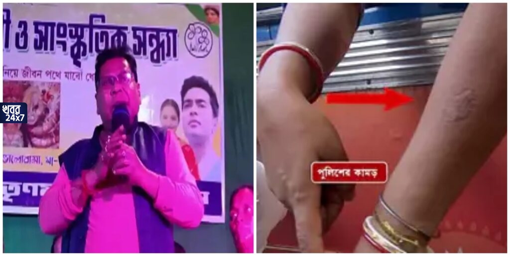 ‘পুলিশ কামড়ে দেবে না তো কী রসগোল্লা ছুঁড়বে নাকি’? চাকরিপ্রার্থীকে পুলিশের কামড়ানো বিতর্কে মন্তব্য তৃণমূল বিধায়কের ‘পুলিশ কামড়ে দেবে না তো কী রসগোল্লা ছুঁড়বে নাকি’? চাকরিপ্রার্থীকে পুলিশের কামড়ানো বিতর্কে মন্তব্য তৃণমূল বিধায়কের