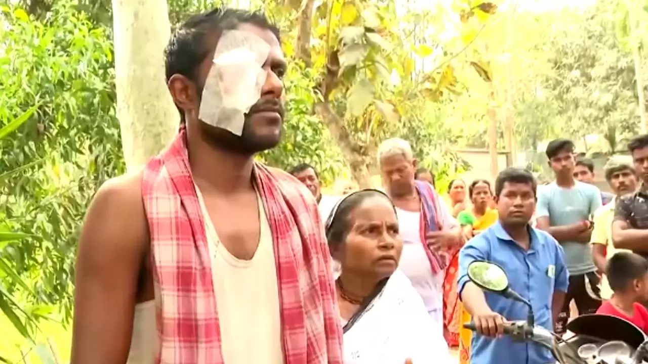 TMC attacked on Voter, Sitalkuchi, voter, attacked, eye, injured, TMC, accusation, 2024 Lok Sabha Election,