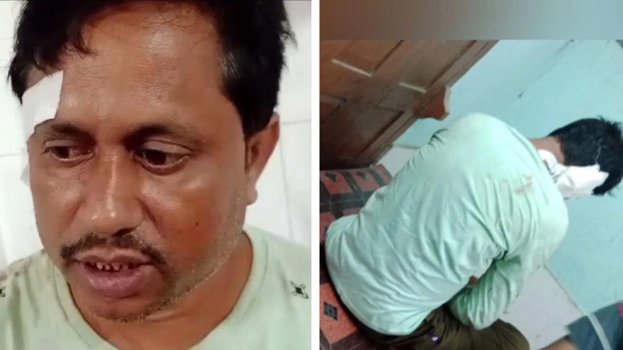BJP Worker attacked by TMC, BJP Worker, TMC, cutting ear, allegation, Bhagwanpur,