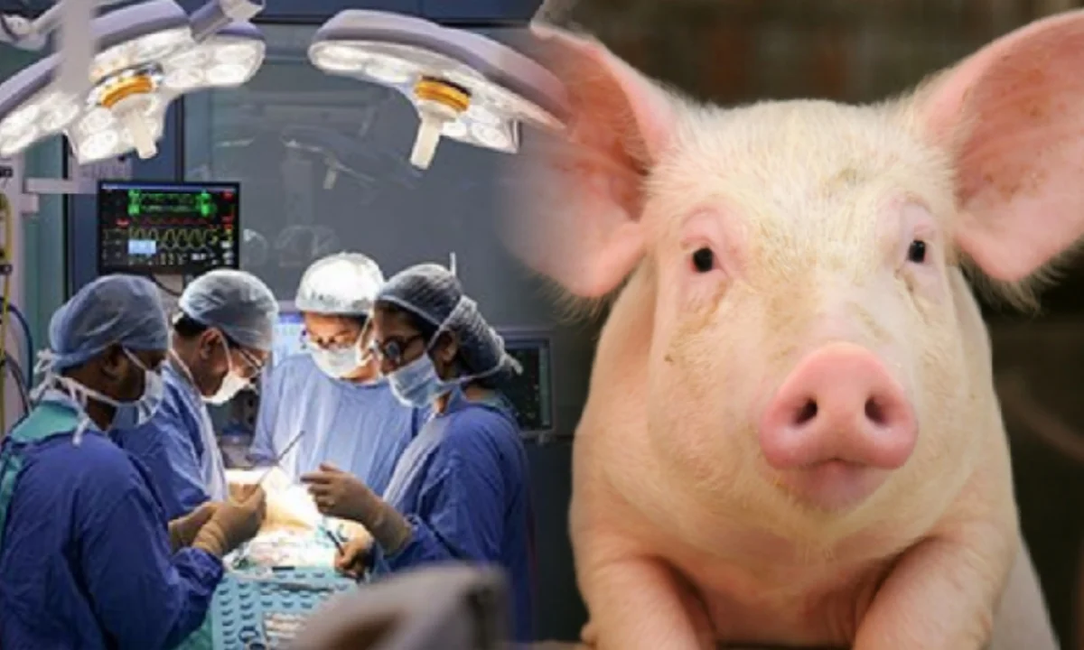 Pig Kidney Transplants, FDA Approves Clinical Trials, US FDA, Gene-Edited Pig Kidney Transplant, আমেরিকা, ফুড অ্যান্ড ড্রাগ অ্যাডমিনিস্ট্রেশন