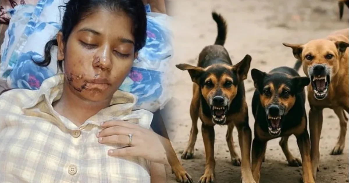 college-girl-injured-in-stray-dog-attack-kanpur