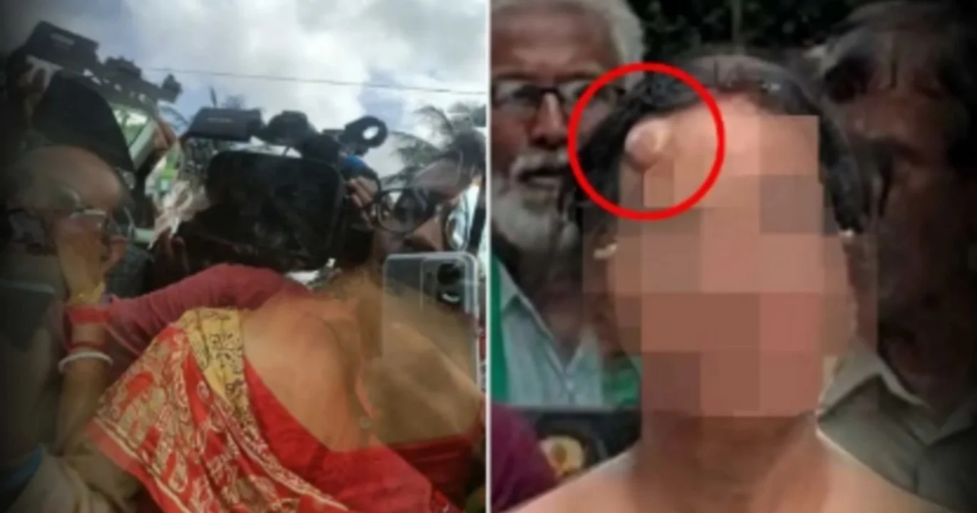 police break the arms of victims parents during protest