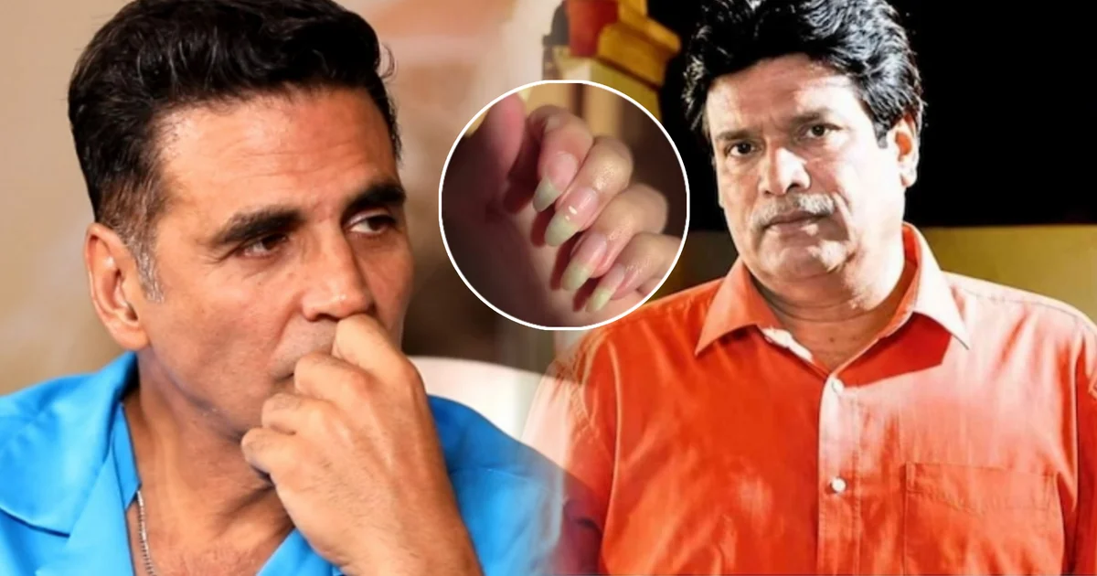 Rajesh Sharma, Akshay Kumar, Rajesh Sharma Health Update, Bengali Actor, Hospitalized Actor, Sudipa Chatterjee, Shubhashis Panda, Health News, Tollywood, Bollywood, রাজেশ শর্মা, অক্ষয় কুমার, রাজেশ শর্মার স্বাস্থ্য, হাসপাতালে ভর্তি, টলিউড, সুদীপা চট্টোপাধ্যায়, শুভাশিস পাণ্ডা, সংক্রমণ, হাই সুগার, বাংলা বিনোদন